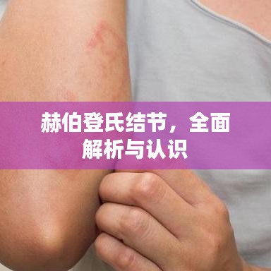 赫伯登氏结节，全面解析与认识