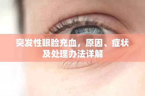 突发性眼睑充血，原因、症状及处理办法详解